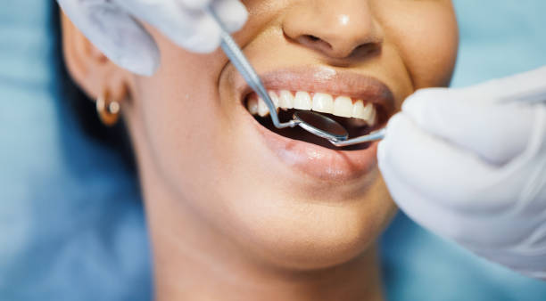 Best Knocked-Out Tooth (Avulsed Tooth) Treatment in Archbald, PA