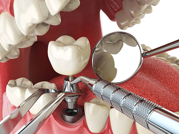Best Dental Abscess Treatment in Archbald, PA